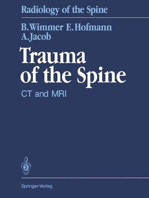 Trauma of the Spine 1