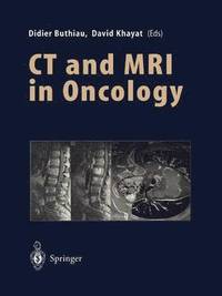 bokomslag CT and MRI in Oncology