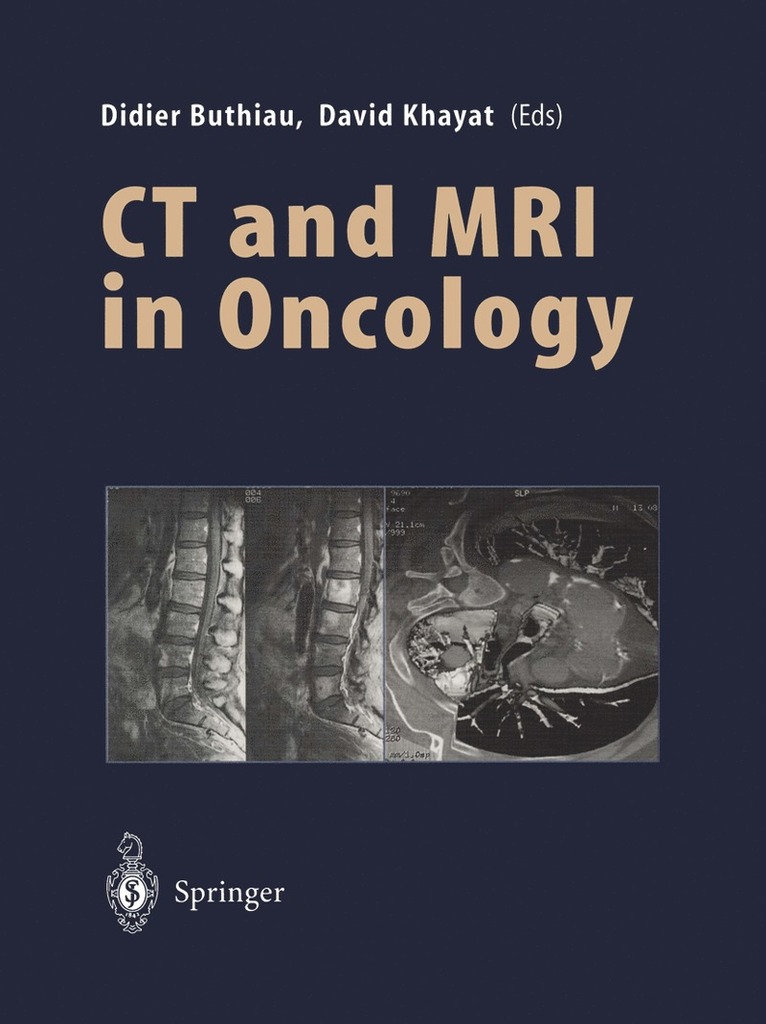 Didier Buthiau, David Khayat - CT and MRI in Oncology, Häftad