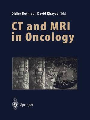 CT and MRI in Oncology 1