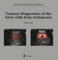 bokomslag Tumour Diagnostics of the Liver with Echo Enhancers