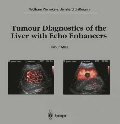 Tumour Diagnostics of the Liver with Echo Enhancers 1