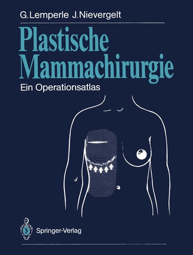 Gottfried Lemperle, Jürg Nievergelt - Plastische Mammachirurgie, Häftad