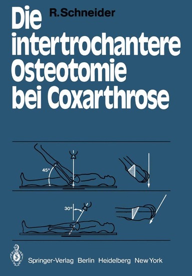 R. Schneider - Die intertrochantere Osteotomie bei Coxarthrose, Häftad