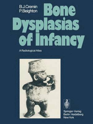 Bone Dysplasias of Infancy 1