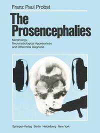 bokomslag The Prosencephalies