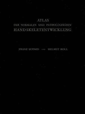 Franz Schmid, Helmut Moll - Atlas der Normalen und Pathologischen Handskeletentwicklung, Häftad
