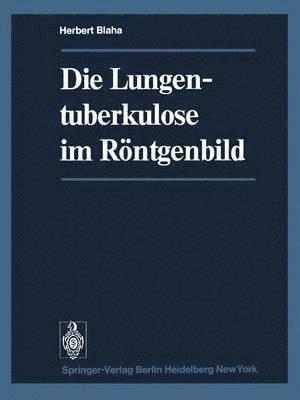 bokomslag Die Lungentuberkulose im Rntgenbild