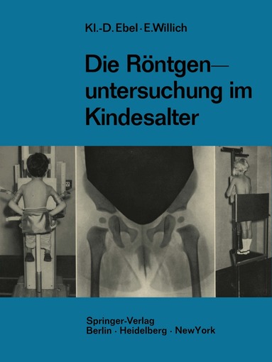 Klaus-Dietrich Ebel, Eberhard Willich - Die Röntgenuntersuchung im Kindesalter, Häftad