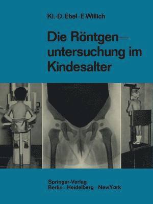Klaus-Dietrich Ebel, Eberhard Willich - Die Röntgenuntersuchung im Kindesalter, Häftad
