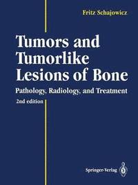 bokomslag Tumors and Tumorlike Lesions of Bone