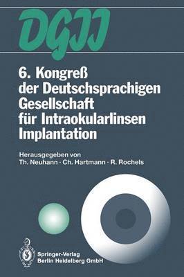 Thomas Neuhann, Christian Hartmann, Rainer Rochels - 6. Kongreß der Deutschsprachigen Gesellschaft für Intraokularlinsen Implantation, Häftad