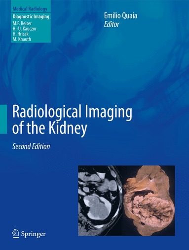 Emilio Quaia - Radiological Imaging of the Kidney, Inbunden