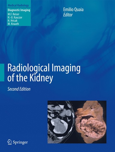 bokomslag Radiological Imaging of the Kidney