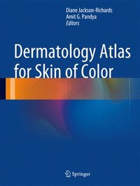 bokomslag Dermatology Atlas for Skin of Color