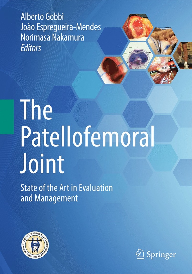 Alberto Gobbi, João Espregueira-Mendes, Norimasa Nakamura, Joao Espregueira-Mendes - Patellofemoral Joint, Inbunden