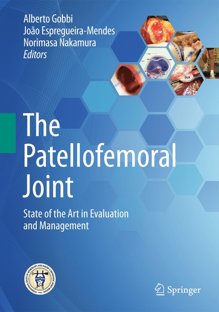 The Patellofemoral Joint 1