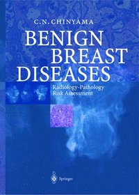 bokomslag Benign Breast Diseases