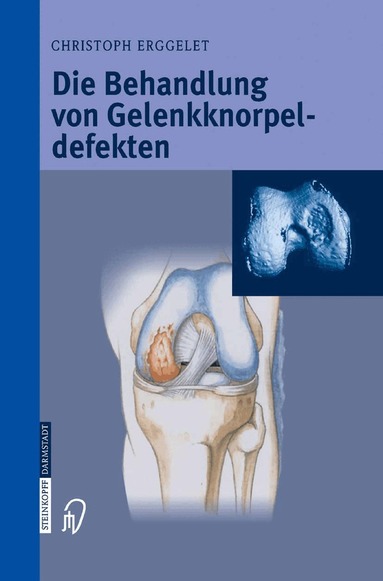 Christoph Erggelet - Die Behandlung von Gelenkknorpeldefekten, Häftad