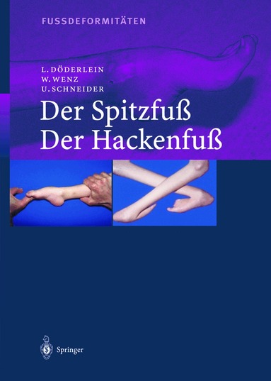 Leonhard Döderlein, Wolfram Wenz, Urs Schneider - Fussdeformitäten, Häftad
