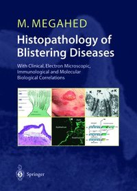 bokomslag Histopathology of Blistering Diseases