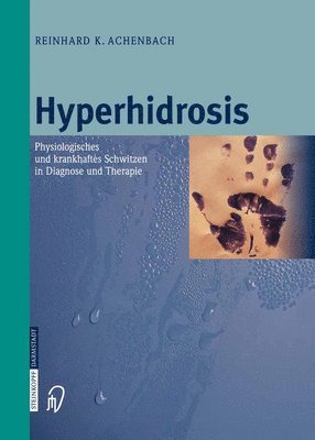 Hyperhidrosis 1