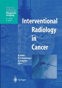 bokomslag Interventional Radiology in Cancer