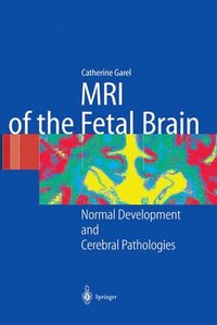 bokomslag MRI of the Fetal Brain