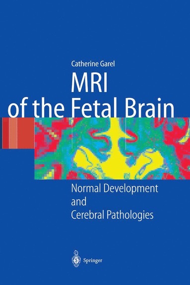 bokomslag MRI of the Fetal Brain