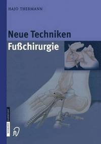 bokomslag Neue Techniken Fusschirurgie