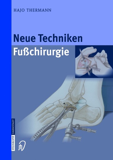 bokomslag Neue Techniken Fusschirurgie