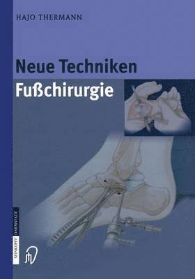 Neue Techniken Fusschirurgie 1