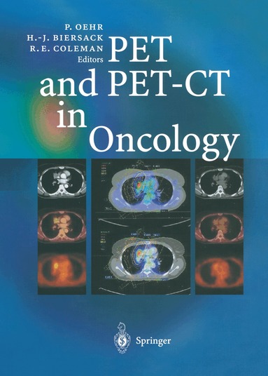 Peter Oehr, Hans-Jürgen Biersack, R. Edward Coleman - PET and PET-CT in Oncology, Häftad