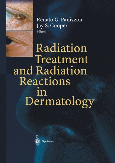 bokomslag Radiation Treatment and Radiation Reactions in Dermatology