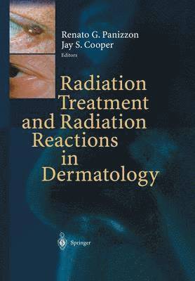 Renato G. Panizzon, Jay S. Cooper - Radiation Treatment and Radiation Reactions in Dermatology, Häftad