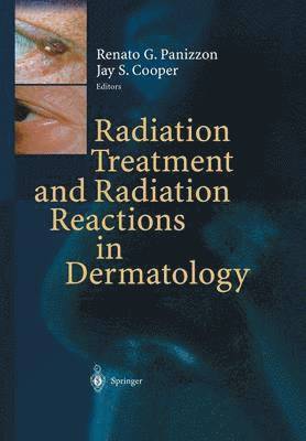 Radiation Treatment and Radiation Reactions in Dermatology 1