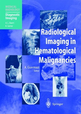 Radiological Imaging in Hematological Malignancies 1