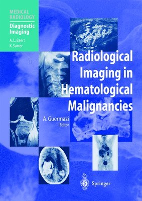 Ali Guermazi - Radiological Imaging in Hematological Malignancies, Häftad