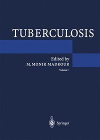 bokomslag Tuberculosis