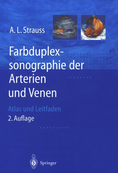 bokomslag Farbduplexsonographie der Arterien und Venen