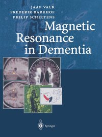 bokomslag Magnetic Resonance in Dementia