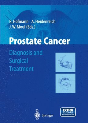 bokomslag Prostate Cancer