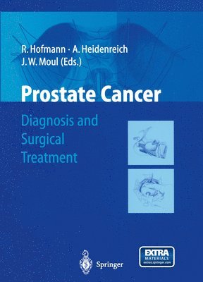 Prostate Cancer 1