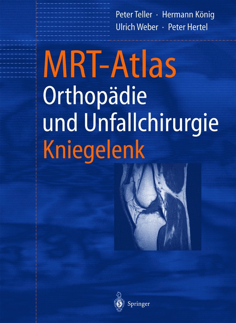 Peter Teller, Hermann König, Ulrich Weber, Peter Hertel, Hermann Konig - MRT-Atlas Orthopädie und Unfallchirurgie, Häftad