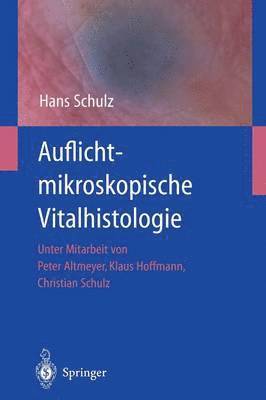 Auflichtmikroskopische Vitalhistologie 1