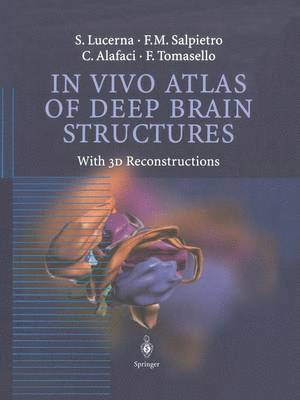 S. Lucerna, F.M. Salpietro, C. Alafaci, F. Tomasello, F. M. Salpietro - In Vivo Atlas of Deep Brain Structures, Häftad