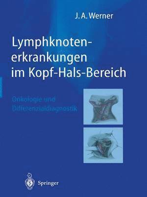 bokomslag Lymphknotenerkrankungen im Kopf-Hals-Bereich