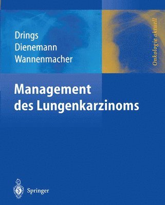 bokomslag Management des Lungenkarzinoms