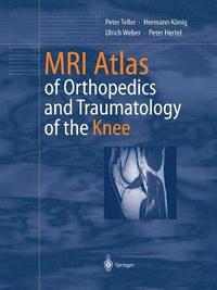 bokomslag MRI Atlas of Orthopedics and Traumatology of the Knee
