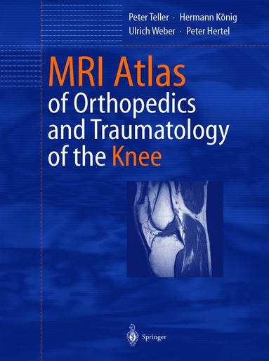 bokomslag MRI Atlas of Orthopedics and Traumatology of the Knee